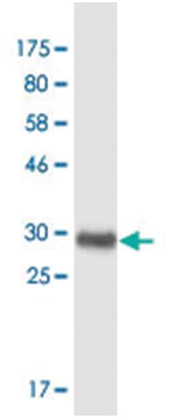 FOXC2 (M02A), Mouse anti-Human, Clone: 2H3, Abnova 200&mu;L; Unlabeled:Antibodies,