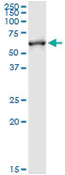 anti-FMO3, Human, IP-WB Antibody Pair, Abnova 1 Set:Antibodies, Monoclonal/Polyclonal
