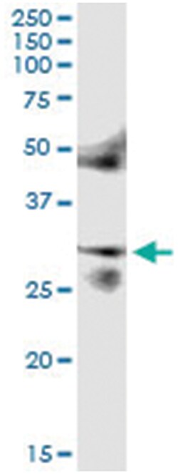anti-FOSL2, Human, IP-WB Antibody Pair, Abnova™