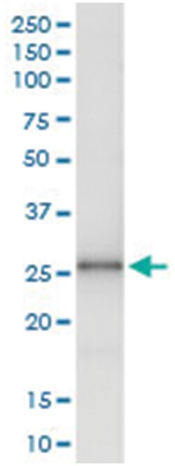 FXN, Human, IP-WB Antibody Pair (PW1), Abnova&trade;