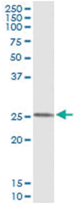 FXN, Human, IP-WB Antibody Pair (PW2), Abnova&trade;