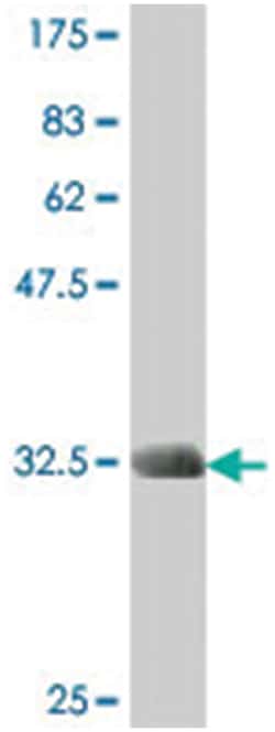 FSHPRH1, Mouse, Polyclonal Antibody, Abnova 50 &mu;L | Buy Online | Abnova Corporation | Fisher Scientific