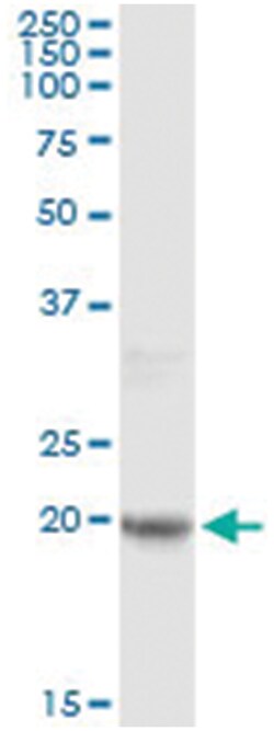 FTL, Human, IP-WB Antibody Pair (PW2), Abnova&trade;