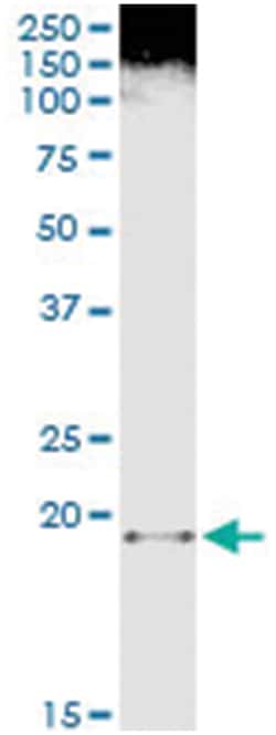 FTL, Human, IP-WB Antibody Pair (PW4), Abnova&trade;