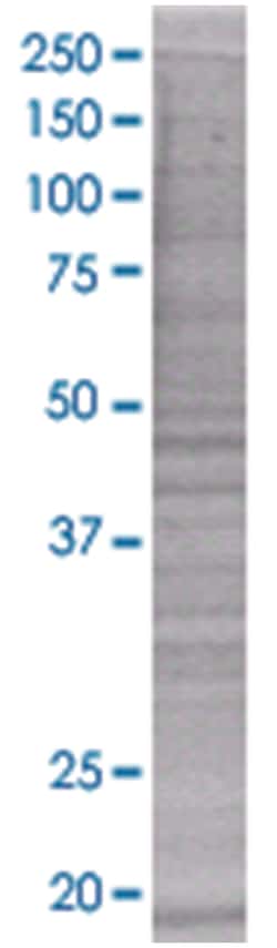 FTL 293T Cell Overexpression Lysate (Denatured), Abnova