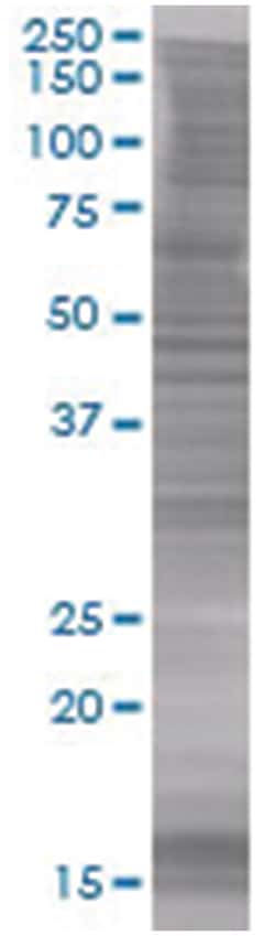 FY 293T Cell Overexpression Lysate 1 (Denatured), Abnova 100 &mu;L | Buy Online | Abnova | Fisher Scientific