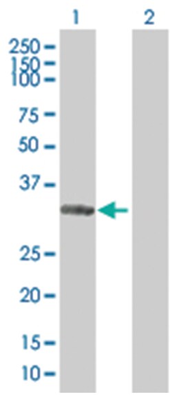 FY 293T Cell Overexpression Lysate 1 (Denatured), Abnova