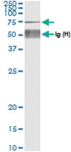anti-XRCC6, Human, IP-WB Antibody Pair, Abnova™