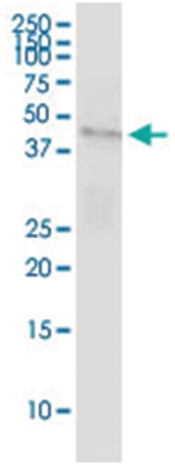 anti-GABPB1, Human, IP-WB Antibody Pair, Abnova&trade;