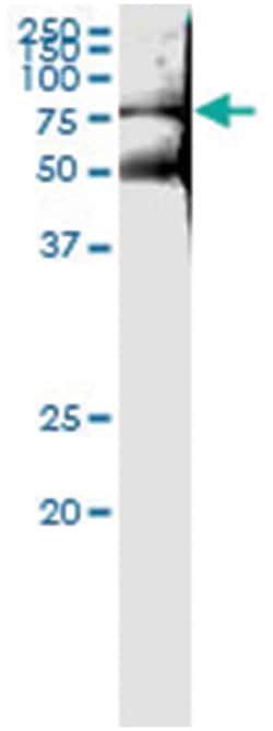 anti-GAD2, Human, IP-WB Antibody Pair, Abnova&trade;