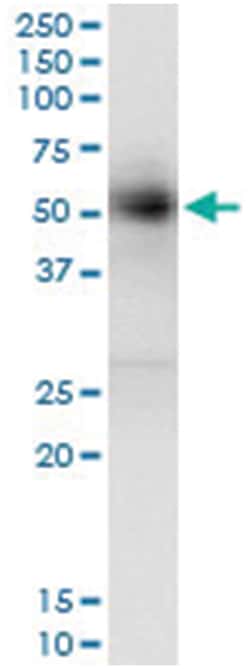 GAK, Human, IP-WB Antibody Pair (PW2), Abnova&trade;