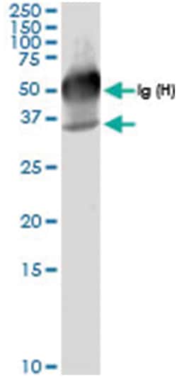 anti-GALE, Human, IP-WB Antibody Pair, Abnova&trade;