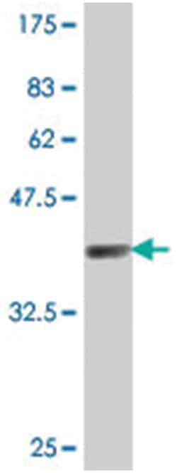 UDP-N-acetyl-alpha-D-galactosamine:polypeptide N-acetylgalactosaminyltransferase 1 (GalNAc-T1), Mouse, Polyclonal Antibody, Abnova 50 &mu;L | Buy Online | Abnova Corporation | Fisher Scientific