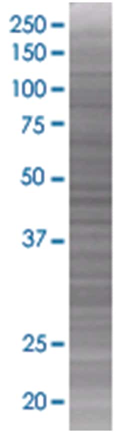 GALNT3 293T Cell Overexpression Lysate (Denatured), Abnova 100 &mu;l:Reagenzien