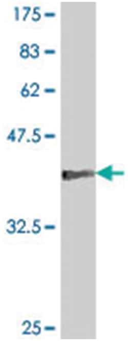 GAPDH, Mouse, Polyclonal Antibody, Abnova&trade;