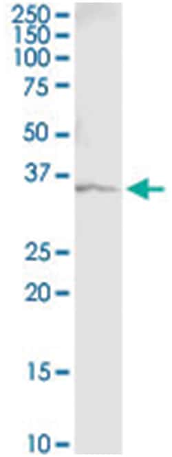 anti-GAPDH, Human, IP-WB Antibody Pair, Abnova 1 Set | Buy Online | Abnova | Fisher Scientific
