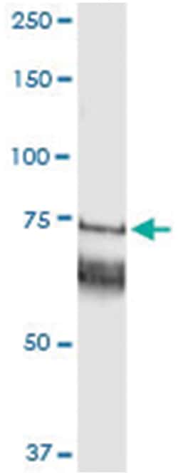 anti-GARS, Human, IP-WB Antibody Pair, Abnova 1 Set:Antibodies, Monoclonal/Polyclonal