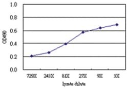 anti-GART Matched Antibody Pair, Abnova&trade;