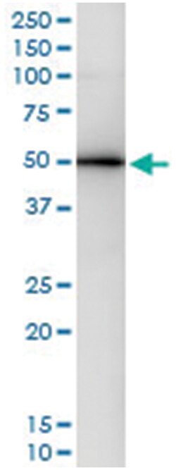 GART, Human, IP-WB Antibody Pair (PW1), Abnova™
