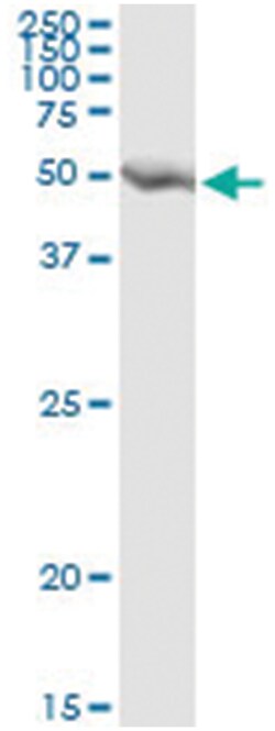 GART, Human, IP-WB Antibody Pair (PW2), Abnova™