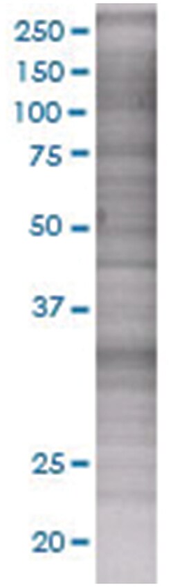 GAS2 293T Cell Overexpression Lysate (Denatured), Abnova 100 &mu;l | Buy Online | Abnova | Fisher Scientific