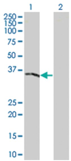 GAS2 293T Cell Overexpression Lysate (Denatured), Abnova 100 &mu;l | Buy Online | Abnova | Fisher Scientific