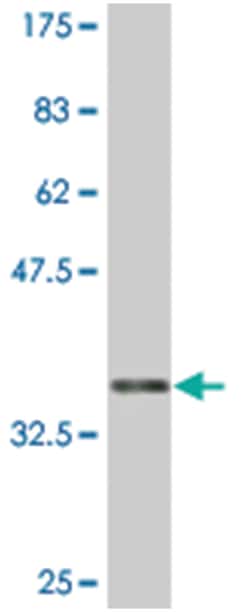 GATA3, Mouse, Clone: 4D10, Abnova 200&mu;L; Unlabeled:Antibodies, Monoclonal