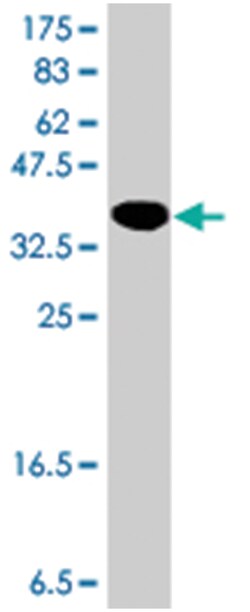 GATA binding protein 6, Mouse, Polyclonal Antibody, Abnova 50&mu;L; Unlabeled:Antibodies,