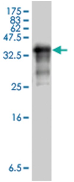 GBA, Mouse, Polyclonal Antibody, Abnova 50&mu;L; Unlabeled:Antibodies,