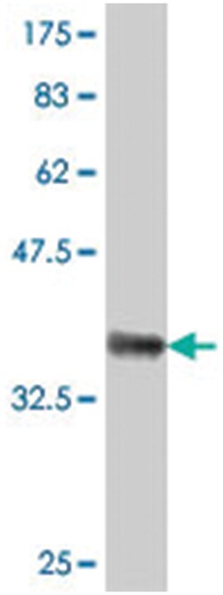GBE1, Mouse, Polyclonal Antibody, Abnova 50&mu;L; Unlabeled:Antibodies,