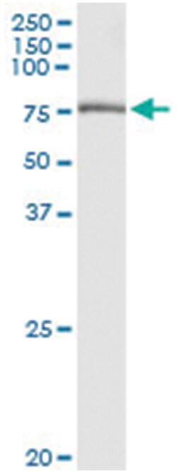 anti-GBE1, Human, IP-WB Antibody Pair, Abnova&trade;