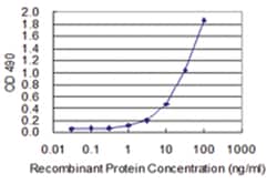 anti-GBP1, Human, Matched Antibody Pair, Abnova&trade;