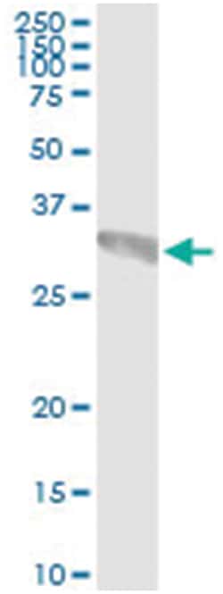 anti-GCH1, Human, IP-WB Antibody Pair, Abnova&trade;