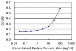 anti-GCK Matched Antibody Pair, Abnova