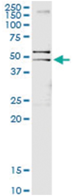 anti-GFAP, Human, IP-WB Antibody Pair, Abnova 1 Set:Antibodies, Monoclonal/Polyclonal