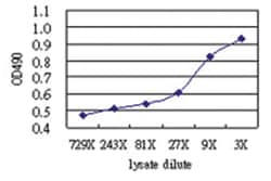 anti-GGT1 Matched Antibody Pair, Abnova&trade;