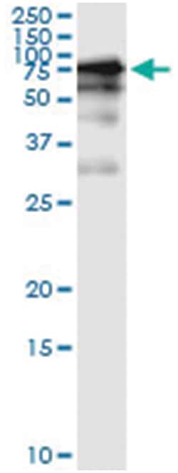 anti-GGT1, Human, IP-WB Antibody Pair, Abnova™