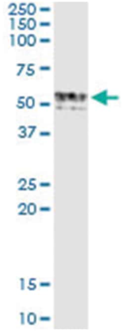 anti-GIF, Human, IP-WB Antibody Pair, Abnova 1 Set:Antibodies, Monoclonal/Polyclonal