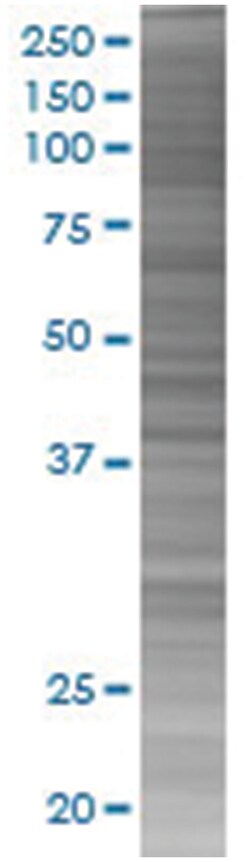GIF 293T Cell Overexpression Lysate (Denatured), Abnova 100 &mu;L | Buy Online | Abnova | Fisher Scientific