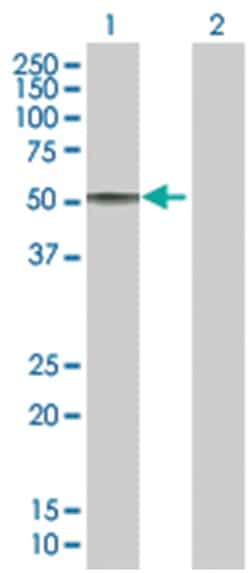 GIF 293T Cell Overexpression Lysate (Denatured), Abnova 100 &mu;L | Buy Online | Abnova | Fisher Scientific
