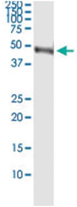 Abnova anti-GLA, Human, IP-WB Antibody Pair, Abnova™