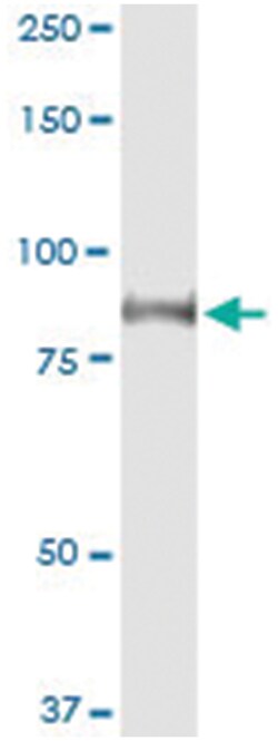 GLB1, Human, IP-WB Antibody Pair (PW2), Abnova™