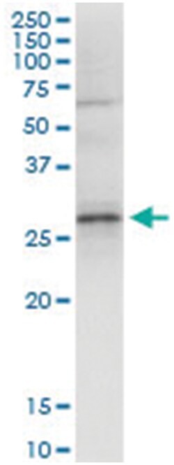 anti-GCLM, Human, IP-WB Antibody Pair, Abnova&trade;
