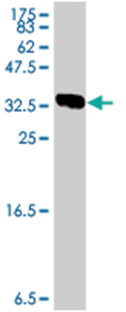 GLS, Mouse, Polyclonal Antibody, Abnova 50&mu;L; Unlabeled:Antibodies,