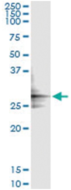 anti-GLUD2, Human, IP-WB Antibody Pair, Abnova&trade;