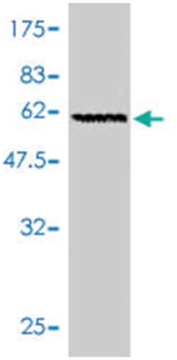 GNB2, Mouse, Polyclonal Antibody, Abnova 50&mu;L; Unlabeled:Antibodies,