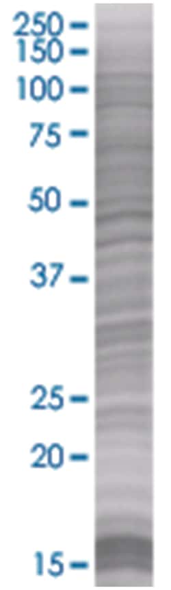 GNG11 293T Cell Overexpression Lysate (Denatured), Abnova 100 &mu;L | Buy Online | Abnova | Fisher Scientific