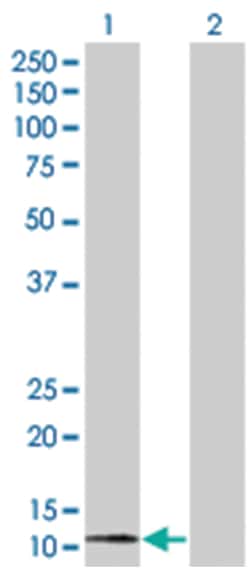 GNG11 293T Cell Overexpression Lysate (Denatured), Abnova 100 &mu;L | Buy Online | Abnova | Fisher Scientific