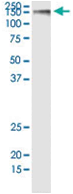 anti-GOLGA2, Human, IP-WB Antibody Pair, Abnova™