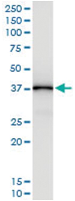 anti-GOT1, Human, IP-WB Antibody Pair, Abnova 1 Set:Antibodies, Monoclonal/Polyclonal
